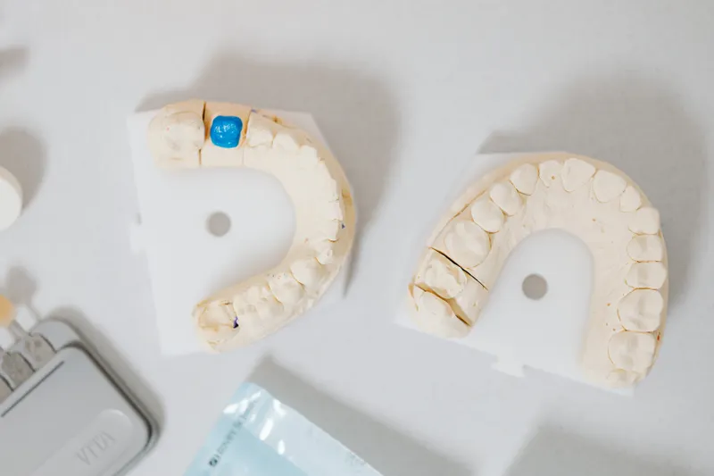 Plaster models of teeth used to make a crown