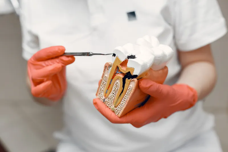 A dentist holds a model of a tooth cut open to show the nerve inside